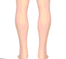 女性用のおしゃれな整形靴
