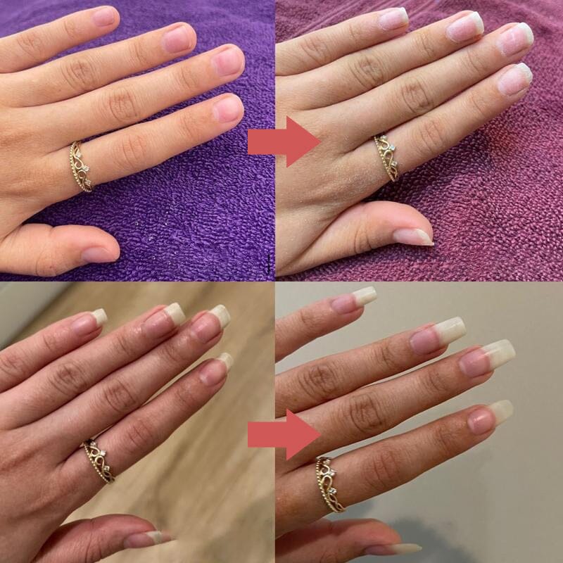 Närande penna för nagelband och torra naglar