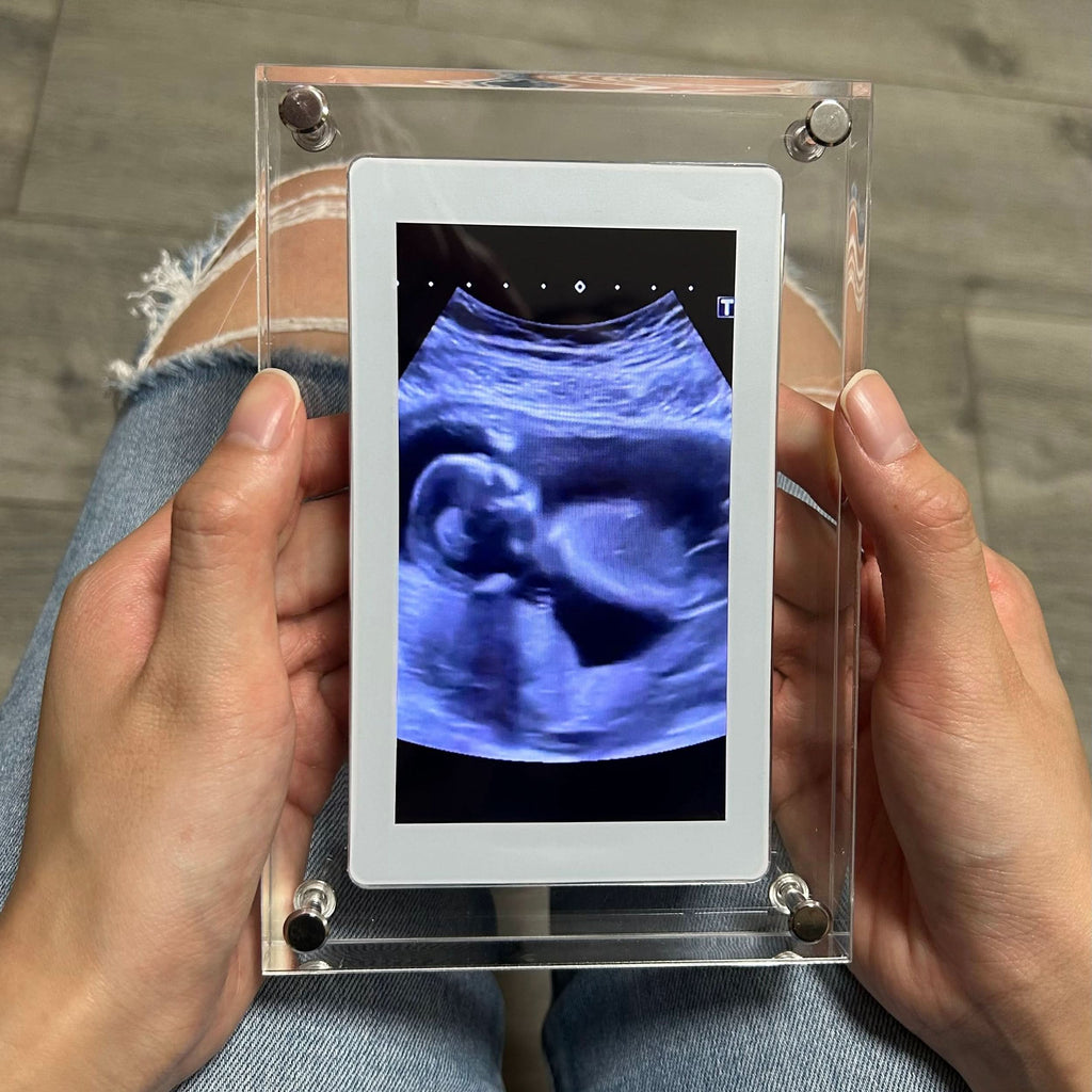Digitale Lichtrahmen für unvergessliche Erinnerungen 
